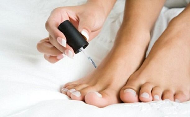 Healing lacquer made of nail fungus